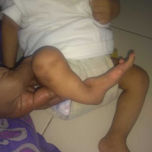 Reaching out to many like Devi