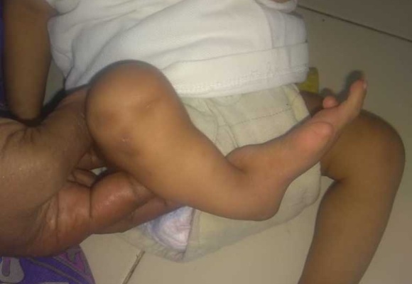 Reaching out to many like Devi